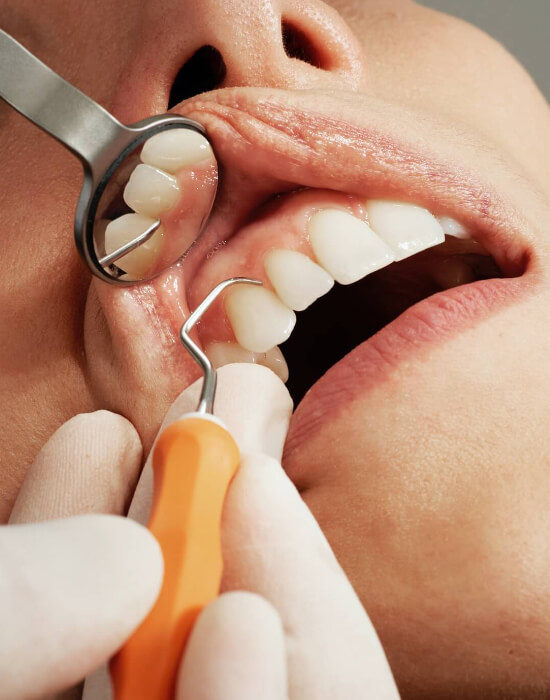 terapie dentara